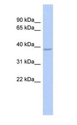 SOX7 antibody Western Blot of Fetal Stomach cell lysate.