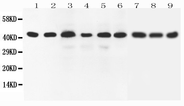 WB of SOX7 antibody. All lanes: Anti-SOX7 at 0.5ug/ml. Lane 1: Rat Brain Tissue Lysate at 40ug. Lane 2: Human Placenta Tissue Lysate at 40ug. Lane 3: Rat Lung Tissue Lysate at 40ug. Lane 4: Rat Testis Tissue Lysate at 40ug. Lane 5: HELA Whole Cell Lysate at 40ug. Lane 6: A549 Whole Cell Lysate at 40ug. Lane 7: HEPG2 Whole Cell Lysate at 40ug. Lane 8: SMMC Whole Cell Lysate at 40ug. Lane 9: NEURO Whole Cell Lysate at 40ug. Predicted bind size: 42KD. Observed bind size: 42KD.