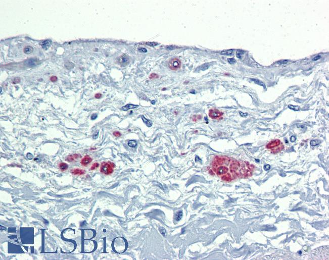 Anti-SOX7 antibody IHC of human heart. Immunohistochemistry of formalin-fixed, paraffin-embedded tissue after heat-induced antigen retrieval. Antibody LS-B4005 concentration 5 ug/ml.