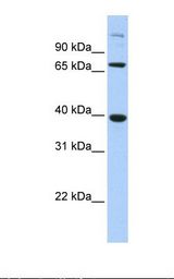 Transfected 293T cell lysate. Antibody concentration: 1.0 ug/ml. Gel concentration: 12%.