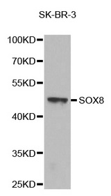 Western blot analysis of extracts of SK-BR-3 cell line, using SOX8 antibody.