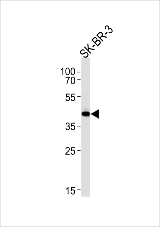 SOX8 Antibody western blot of SK-BR-3 cell line lysates (35 ug/lane). The SOX8 antibody detected the SOX8 protein (arrow).