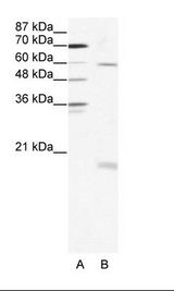 A: Marker, B: HepG2 Cell Lysate