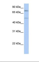 Fetal muscle lysate. Antibody concentration: 1.0 ug/ml. Gel concentration: 12%.