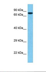 Western blot of Human A549. SP1 antibody dilution 1.0 ug/ml.