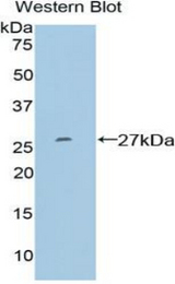 Western blot of recombinant SP100.