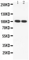 WB of SP100 antibody. All lanes: Anti-SP100 at 0.5ug/ml. Lane 1: U937 Whole Cell Lysate at 40ug. Lane 2: HEPG2 Whole Cell Lysate at 40ug. Predicted bind size: 100KD. Observed bind size: 100KD.