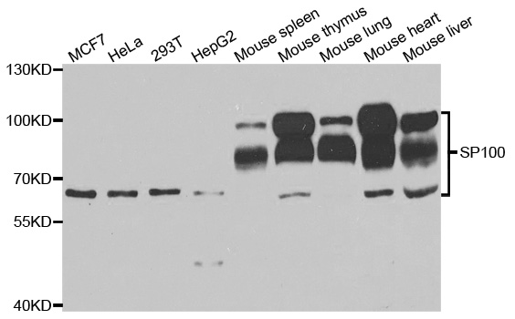 Western blot analysis of extracts of various cell lines, using SP100 antibody.