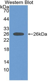Western blot of recombinant SP100.
