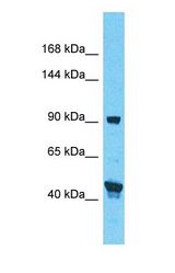 Western blot of SP100 Antibody with human 721_B Whole Cell lysate.