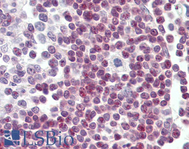 Anti-SP110 antibody IHC of human tonsil. Immunohistochemistry of formalin-fixed, paraffin-embedded tissue after heat-induced antigen retrieval. Antibody LS-B4180 concentration 3.75 ug/ml.