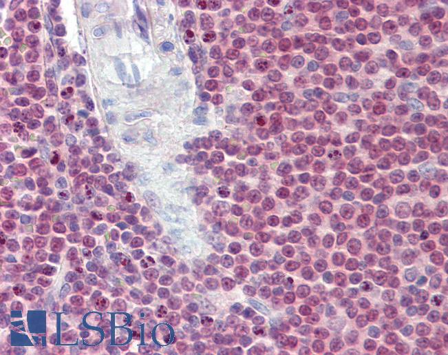 Anti-SP110 antibody IHC of human spleen. Immunohistochemistry of formalin-fixed, paraffin-embedded tissue after heat-induced antigen retrieval. Antibody LS-B4180 concentration 3.75 ug/ml.