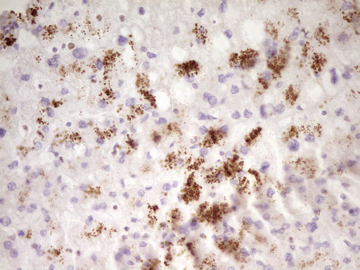 IHC of paraffin-embedded Human liver tissue using anti-SP110 mouse monoclonal antibody. (Heat-induced epitope retrieval by 1 mM EDTA in 10mM Tris, pH8.5, 120°C for 3min).