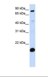MCF7 cell lysate. Antibody concentration: 1.0 ug/ml. Gel concentration: 12%.