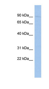 SP110 antibody LS-C110122 Western blot of HT1080 cell lysate.