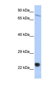 SP110 antibody LS-C110218 Western blot of HepG2 cell lysate.