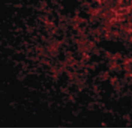 Immunofluorescence of IPR1 in Human Brain cells with IPR1 antibody at 50 ug/ml.