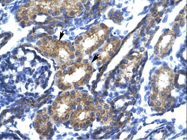 SP140 antibody LS-C30581 was used in IHC to stain formalin-fixed, paraffin-embedded human kidney.