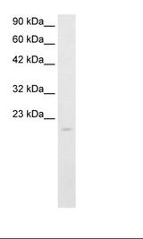 Raji Cell Lysate