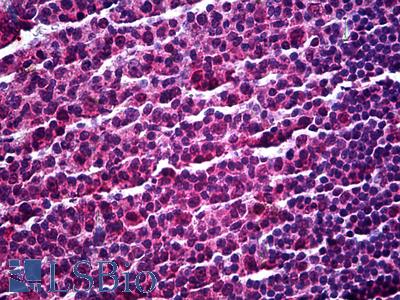 Anti-SP140 antibody IHC of human tonsil. Immunohistochemistry of formalin-fixed, paraffin-embedded tissue after heat-induced antigen retrieval. Antibody LS-B6030 concentration 5 ug/ml.