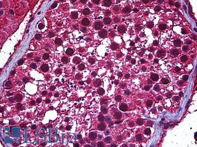 Anti-SP140 antibody IHC of human testis. Immunohistochemistry of formalin-fixed, paraffin-embedded tissue after heat-induced antigen retrieval. Antibody LS-B6030 concentration 5 ug/ml.