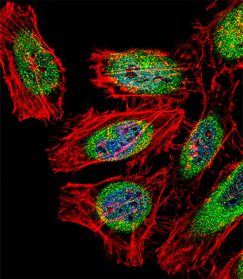 Fluorescent confocal image of HeLa cell stained with SP140 Antibody. HeLa cells were fixed with 4% PFA (20 min), permeabilized with Triton X-100 (0.1%, 10 min), then incubated with SP140 primary antibody (1:25, 1 h at 37°C). For secondary antibody, Alexa Fluor 488 conjugated donkey anti-rabbit antibody (green) was used (1:400, 50 min at 37°C). Cytoplasmic actin was counterstained with Alexa Fluor 555 (red) conjugated Phalloidin (7units/ml, 1 h at 37°C). Nuclei were counterstained with DAPI (blue) (10 ug/ml, 10 min). SP140 immunoreactivity is localized to Cytoplasm and Nucleus significantly.