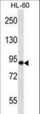 SP140 Antibody western blot of HL-60 cell line lysates (35 ug/lane). The SP140 antibody detected the SP140 protein (arrow).