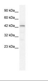 Jurkat Cell Lysate