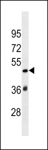 SP140L Antibody western blot of CEM cell line lysates (35 ug/lane). The SP140L Antibody detected the SP140L protein (arrow).