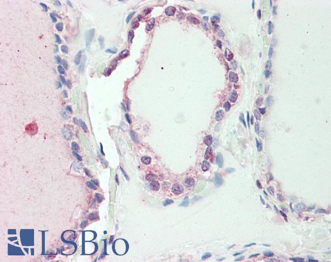 Anti-SP2 antibody IHC staining of human thyroid. Immunohistochemistry of formalin-fixed, paraffin-embedded tissue after heat-induced antigen retrieval. Antibody LS-B10251 concentration 10 ug/ml.