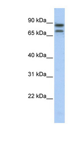 SP2 antibody Western blot of Transfected 293T cell lysate.