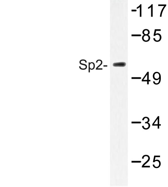 Western blot of Sp2 (D512) pAb in extracts from Jurkat cells.