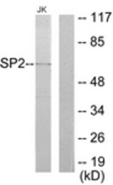 Western blot of extracts from Jurkat cells, using SP2 Antibody. The lane on the right is treated with the synthesized peptide.