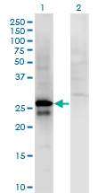 Western Blot analysis of SP2 expression in transfected 293T cell line by SP2 monoclonal antibody (M01), clone 5D3.Lane 1: SP2 transfected lysate (Predicted MW: 25.6 KDa).Lane 2: Non-transfected lysate.