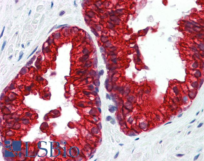 Anti-SP3 antibody IHC of human prostate. Immunohistochemistry of formalin-fixed, paraffin-embedded tissue after heat-induced antigen retrieval. Antibody LS-B3502 concentration 5 ug/ml.