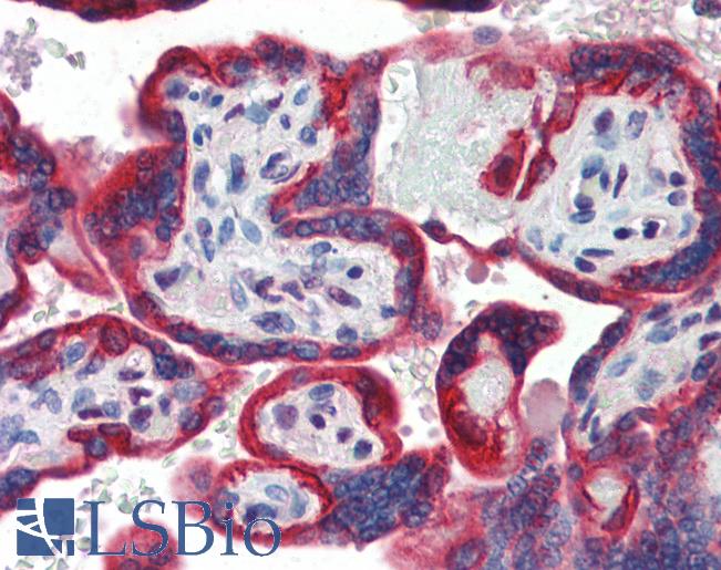 Anti-SP3 antibody IHC of human placenta. Immunohistochemistry of formalin-fixed, paraffin-embedded tissue after heat-induced antigen retrieval. Antibody LS-B3502 concentration 5 ug/ml.