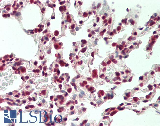 Mouse Lung: Formalin-Fixed, Paraffin-Embedded (FFPE)
