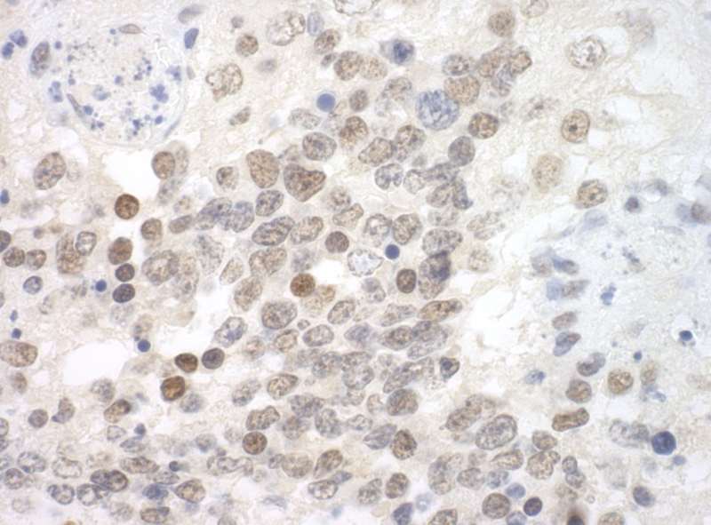 Detection of Mouse Sp3 by Immunohistochemistry. Sample: FFPE section of mouse teratoma. Antibody: Affinity purified rabbit anti-Sp3 used at a dilution of 1:100.