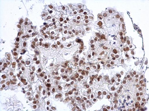 Anti-SP3 antibody used in IHC (Formalin-fixed paraffin-embedded sections).