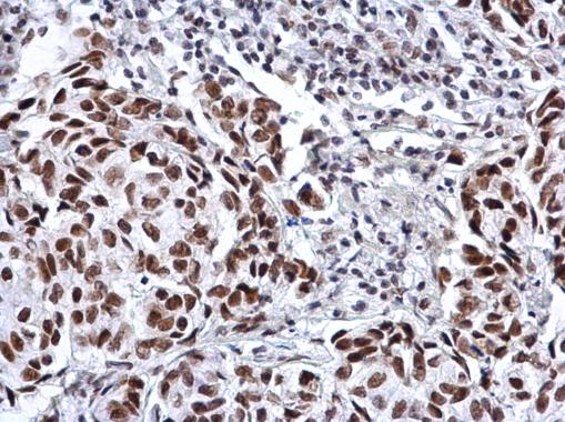 Anti-SP3 antibody used in IHC (Formalin-fixed paraffin-embedded sections).