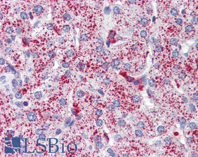 Anti-SP4 antibody IHC of human liver. Immunohistochemistry of formalin-fixed, paraffin-embedded tissue after heat-induced antigen retrieval. Antibody LS-B3521 concentration 5 ug/ml.