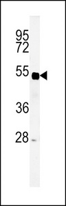 Western blot of SP5 Antibody in mouse liver tissue lysates (35 ug/lane). SP5 (arrow) was detected using the purified antibody.