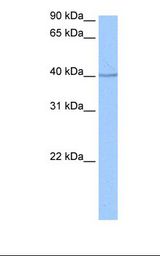 Jurkat cell lysate. Antibody concentration: 0.5 ug/ml. Gel concentration: 12%.