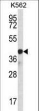 SP6 Antibody western blot of K562 cell line lysates (35 ug/lane). The SP6 antibody detected the SP6 protein (arrow).