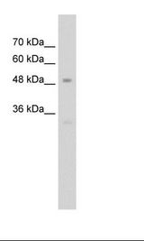 Jurkat Cell Lysate
