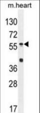 SP8 Antibody western blot of mouse heart tissue lysates (35 ug/lane). The SP8 antibody detected the SP8 protein (arrow).