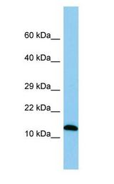 SPA17 / Sperm Protein 17 antibody Western Blot of Rat Small Intestine.