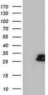 HEK293T cells were transfected with the pCMV6-ENTRY control (Left lane) or pCMV6-ENTRY SPA17 (Right lane) cDNA for 48 hrs and lysed. Equivalent amounts of cell lysates (5 ug per lane) were separated by SDS-PAGE and immunoblotted with anti-SPA17.