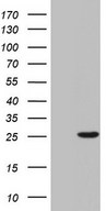 HEK293T cells were transfected with the pCMV6-ENTRY control (Left lane) or pCMV6-ENTRY SPA17 (Right lane) cDNA for 48 hrs and lysed. Equivalent amounts of cell lysates (5 ug per lane) were separated by SDS-PAGE and immunoblotted with anti-SPA17.
