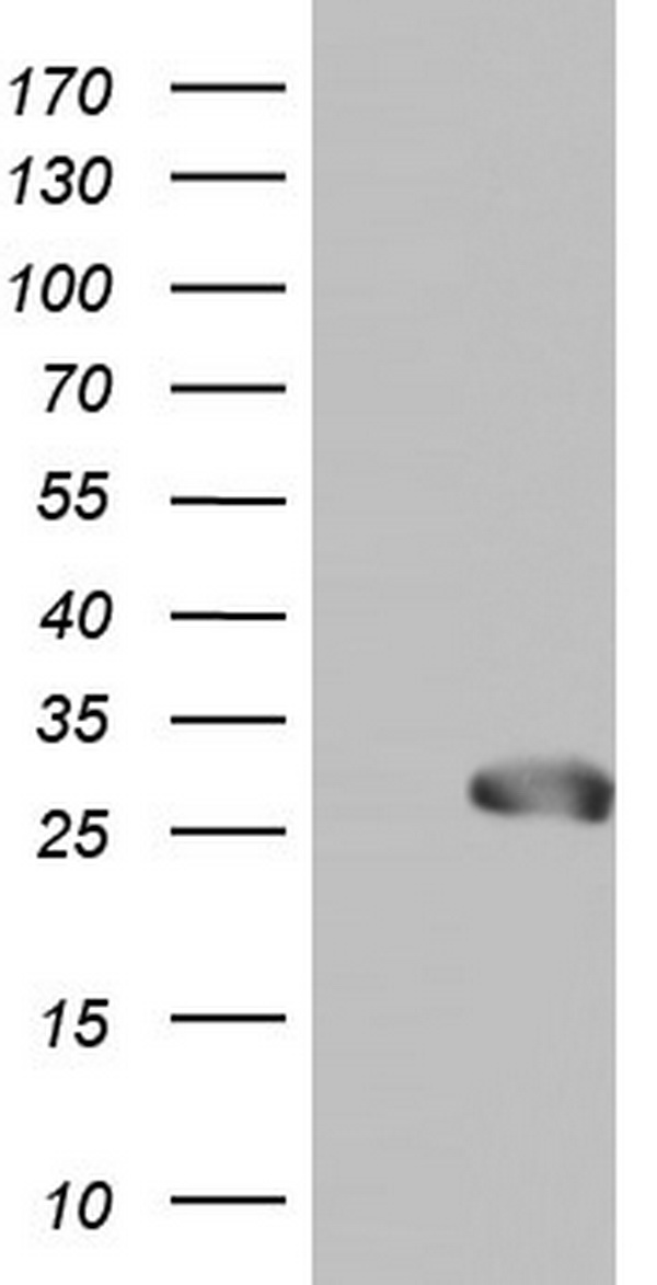 HEK293T cells were transfected with the pCMV6-ENTRY control (Left lane) or pCMV6-ENTRY SPA17 (Right lane) cDNA for 48 hrs and lysed. Equivalent amounts of cell lysates (5 ug per lane) were separated by SDS-PAGE and immunoblotted with anti-SPA17.